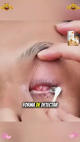 Las gotas oculares de miel hacen que el mundo sea más nítido. Ahora hay descuento. Las gotas de miel pueden hacer que tus ojos sean más brillantes. Ahora hay descuento, apresúrate a comprar.#eyes #eyecare #TikTokShopLaborDaySale #TikTokShopRestock #eyehealth 