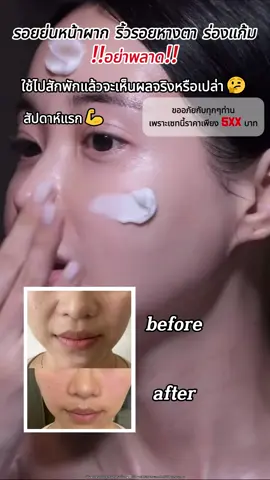 ใช้ต่อเนื่องผิวจะขาวใสเนียนนุ่ม~✨🥰#papafeel#papafeelth#ultra5a#ส่วนผสมเรตินอลต่อต้านวัยอันดับหนึ่ง#antiaging#repair#คนไทยเป็นคนตลก#trending