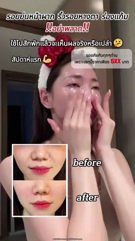 ใช้ต่อเนื่องผิวจะขาวใสเนียนนุ่ม~✨🥰#papafeel#papafeelth#ultra5a#ส่วนผสมเรตินอลต่อต้านวัยอันดับหนึ่ง#antiaging#repair#คนไทยเป็นคนตลก#trending