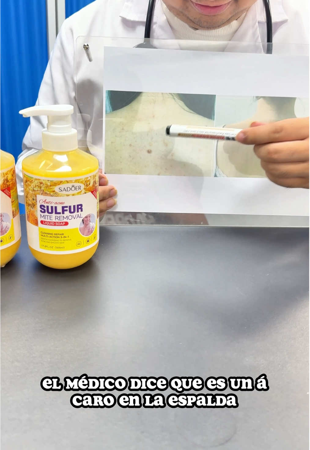 Cy jAdiós Acné y Grasa! Gel Corporal con Árbol de Té y Azufre3  #GelAntiacaros #CuidadoDeLaPiel #EspaldaLimpia #AcnéFuera #AdiósGranos #GelDeDucha #CuidadoCorporal #PielSaludable #Niacinamida#ÃrbolDeTé#AzufreNatural#RutinaDeBaño #LimpiezaProfunda#CuidadoDiario #DermatológicamenteProbado#GelPurificante#PielSinÁcaros#EliminaElAcné #CuidadoNatura #EspaldaSinBrotes