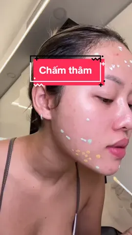 Trả lời @Anna Phạm KT chân ái về rồi #linhbaeli #gọitêntuilàbâyli #skincare #chamtham #byebyeblemish 