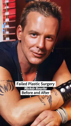 Celebrities who are unrecognizable after plastic surgery failures,Before and After #entertainment #celebrity #fyp #usa #disfiguredface 