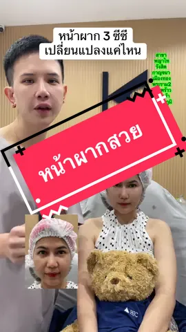 ฟิลเลอร์หน้าผากเปลี่ยนแปลงขนาดขนาดไหนมาดูกัน #ฟิลเลอร์หน้าผาก #ปรับรูปหน้า #หน้าสั้น #