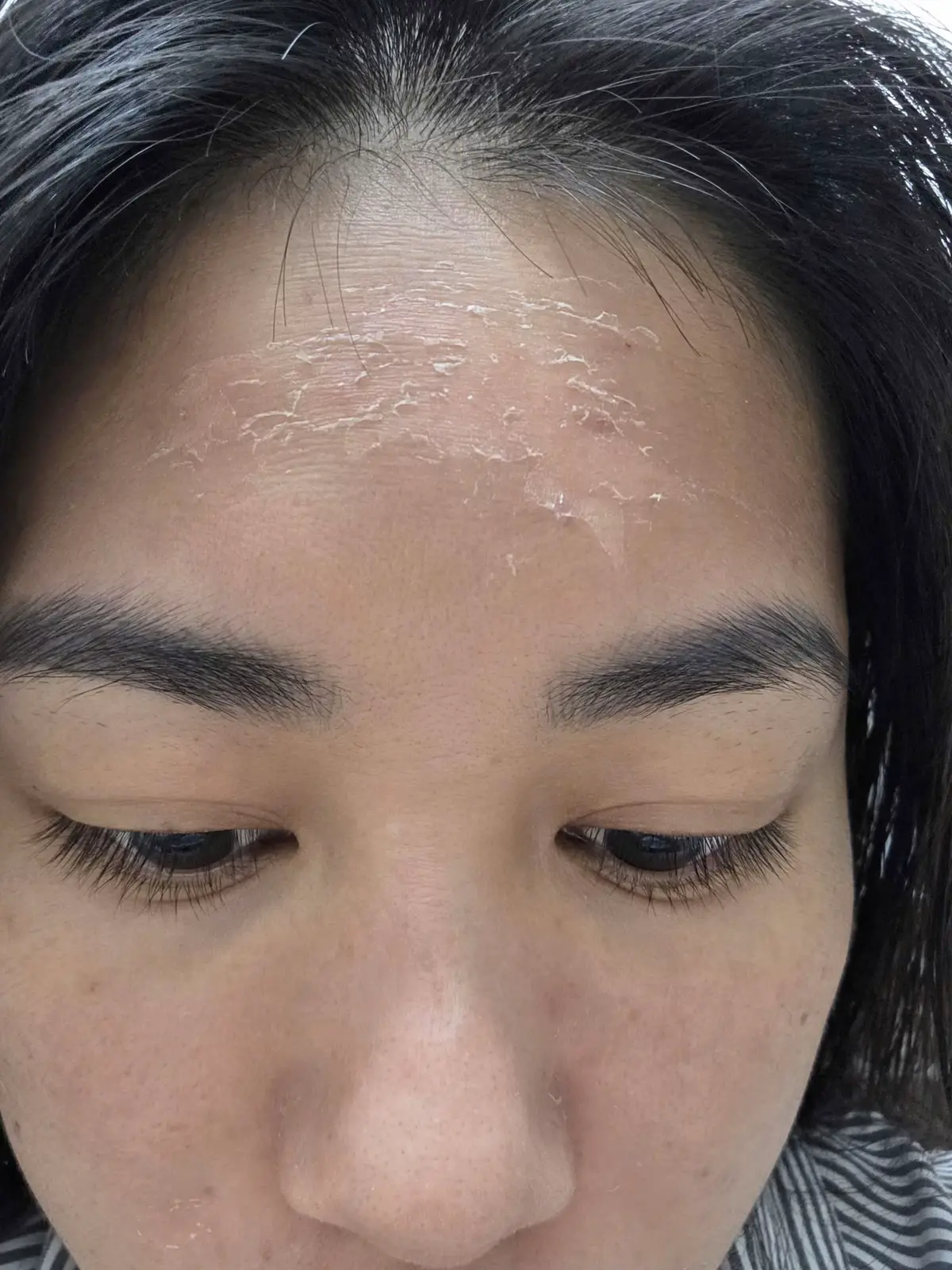 Nhìn khách peel mà e cũng muốn peel, bong đều nha #peel #peelda #decaar #munan #lamdep 