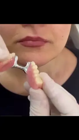 #implants #denture #dental #full #teeths #foryoupage❤️❤️ 