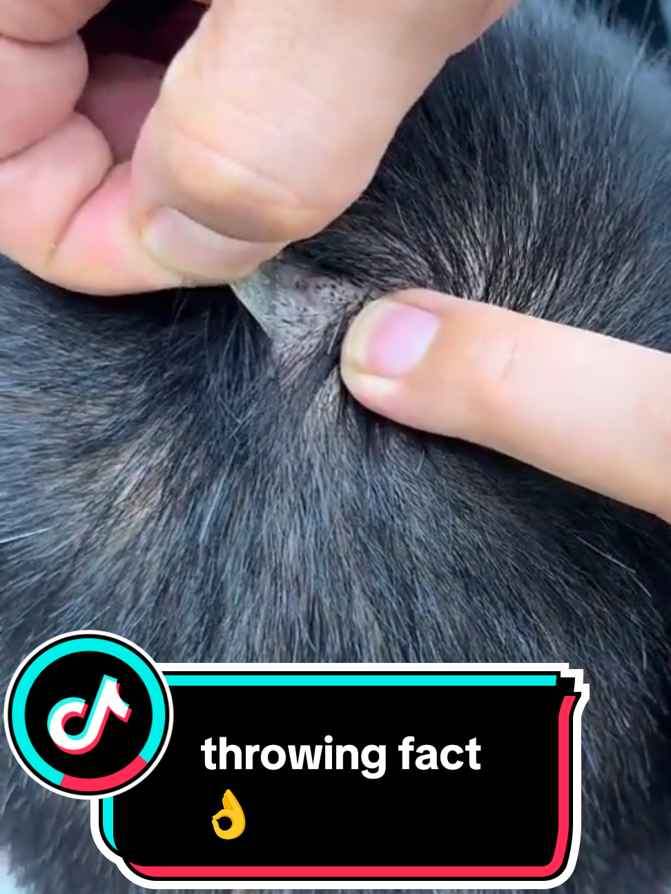 what was stuck in this boy's hair's #shortvideo #foryou #trending #challange #viwesproblem 