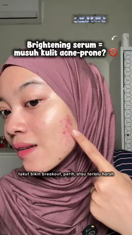 Biasanya brightening serum bikin was-was, tapi yang ini surprisingly cocok di kulit acne-prone 👌 #serumacne #acneproneskin #brighteningskincare #youserum #bekasjerawat  