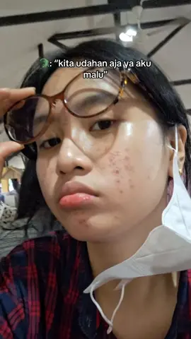 daki nyaa ga bangett😱 #GlowUp #foryou 