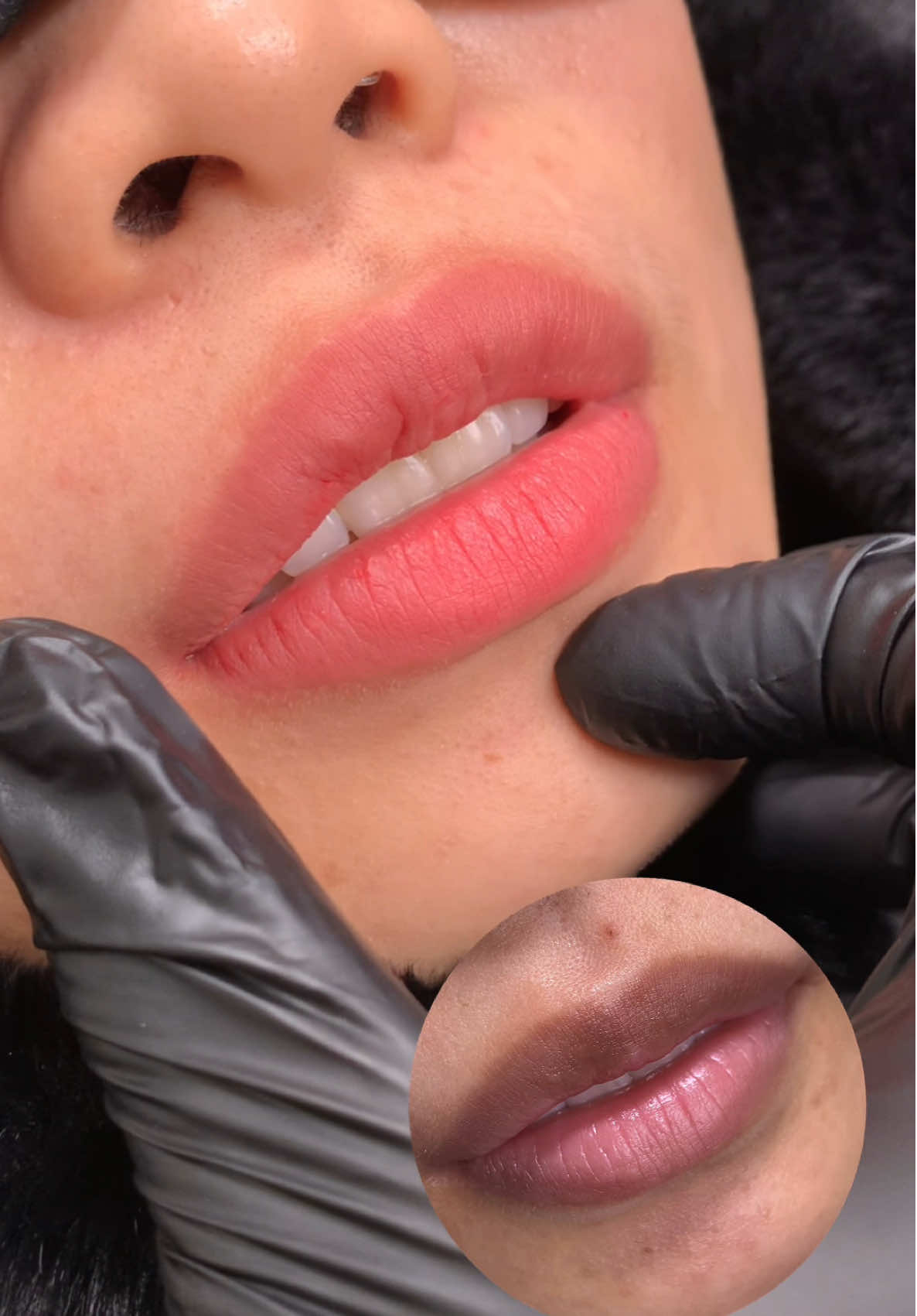 Phun môi mà hối hận thì chắc là tìm sai chỗ mất rồi , chưa đúng gu thôi, chứ chọn đúng thì chỉ có mê tít 😘 Ai thích style nhẹ nhàng, tự nhiên thì về team em nha 😉 _ _ _ _ _ _ _ _ _ _ _ _ _   𝑴𝙤𝒍𝙞𝒔𝙚 𝘽𝒆𝙖𝒖𝙩𝒚 & 𝒄𝙞𝒍𝙞𝒏𝙞𝒄 [ AddRess ] : Tầng 3 , 523 Hoàng Sa , P.Võ Thị Sáu , Q.3 [ Hotline ] : 0779432031  [ intagram ] : MoliseBeauty & Clinic [ Opening time ] : 10 a.m - 7 p.m #phunmoi #khuthammoi #khutham #phunxămthẩmmỹ #phunxamsaigon        