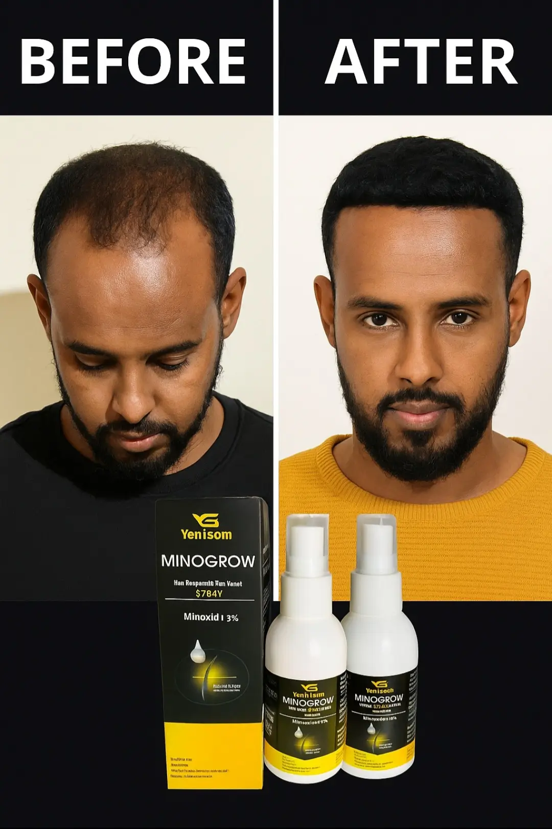 #somalitiktok #somalitiktok #somalilandtiktok💚🤍❤ #foryoupage #viralvideotiktok 