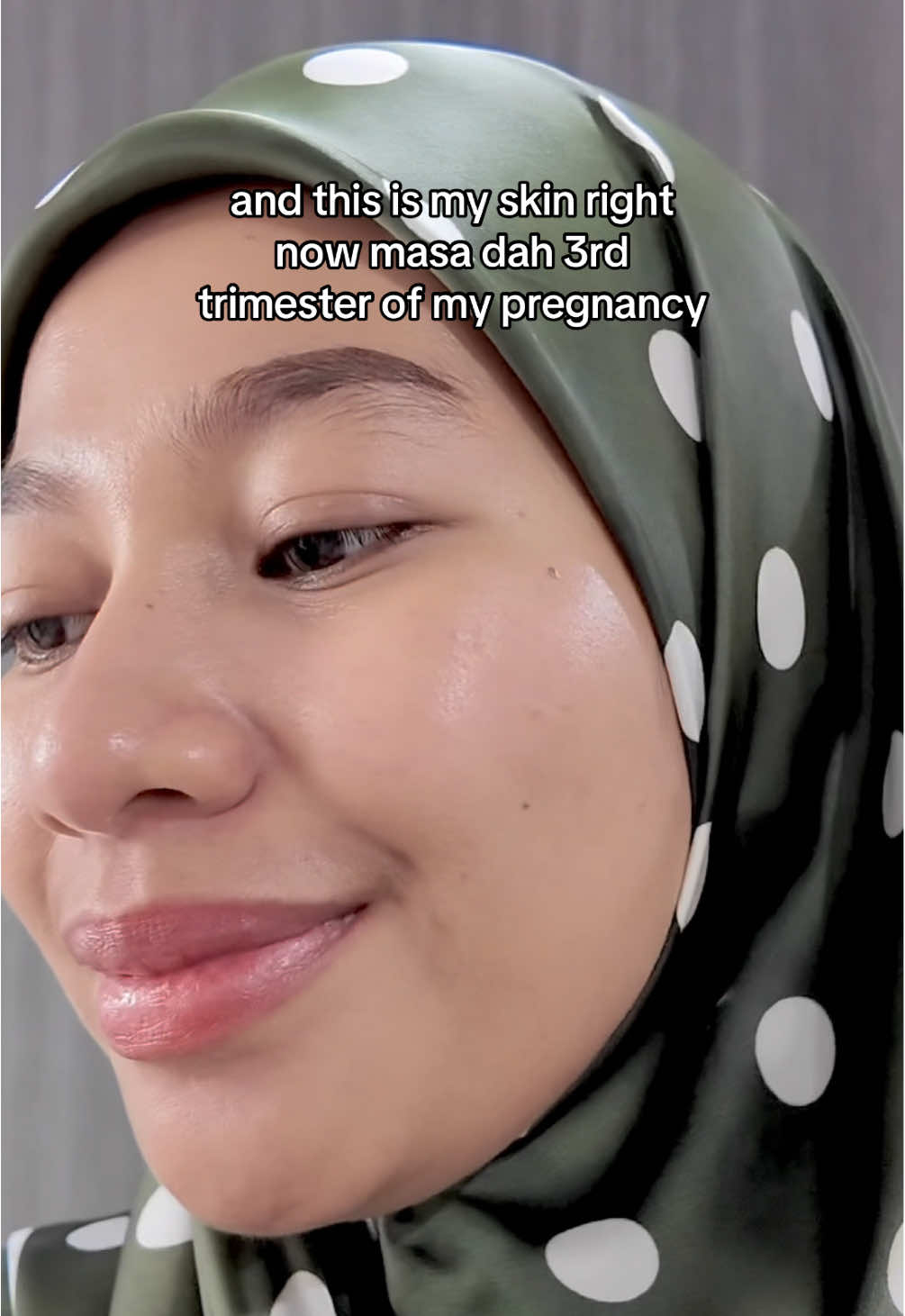 Nak glow up during pregnancy?! Jgn risau masa pregnant ni biasa nya mom to be mesti rasa lemah lesu letih. Sampai kadang2 tak terjaga pun skin kan? Sama laa kitaaaa! I skip my skincare during my first trimester sbb tu laa skin jadi mcm tuu 🥲 Tp after that, dah ada tenaga balik slowly kita pakai & jaga skin balik 🙌🏻 And yg best nya, i tak perlu dah risau nak kena tukar item skincare i, sbb Dr Secret skincare is totally safe for pregnant mom & breastfeeding mom 🫶🏻🥰 Sbb tu laa until now, my skin are getting better & i can see the glow up during my pregnancy 🫣🥹 So yg mana pregnant mommy yg ada skin problem, jgn risau boleh jee nak treat skin masa nii, jomm yat bantu ok! ❤️ #pregnantmom #pregnantskin #skincareforpregnantmom #skincaretips #healthyskin 
