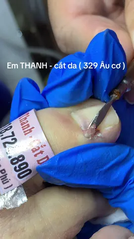 #em_thanh_cắt_da_329âucơ #lấykhóe #lấykhoétphcm #lênxuhướng #xuhuong 