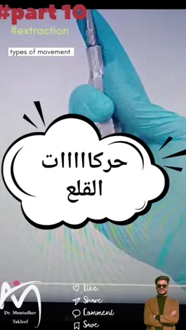 السلام عليكم 🫡 اني مُنتظر تكليف 🤓  وفيديو اليوم عن 👇 ⬅️ الجزء الرابع عشر من سلسلة تعلم القلع ( حركات القلع) :- بالبداية خلي نفهم عملية القلع 😬 ● القلع عبارة عن مجموعة من الحركات الي يسويها الطبيب، لكُل سن اله فد حركة مميزة عن غيرها . ••••••••••••••••••••••••••••••••••••••••••••• ●الحركات لكل سن تختلف حسب نوع الاداة اذا كانت فورسبس او اليفيتر والتكنيكات هواي :- ●●●●●●●●●●●●●●●●●●□□□□□●● ■بصورة رئيسيه بالفورسبس عدنة نوعين اساسيات : اولًا / حركة السن بصورة خطية يعني(platal -buccal).  ثانيًا /  هي الحركة الدورانية. س/ شنو الفرق بينهم؟ وشوكت نستخدم كل واحد منهم ؟   ج /اولا/ الحركة الخطية : نستخدمها مع الاسنان الي بيها اكثر من جذر. س / شلون تصير هلحركة او شلون نسويها؟؟  ج / نكدر نسويها من خلال انه نلزم الكراون بالفورسبس ونحركه بصوره بسيطه ونسبية شويه باتجاه البلت وشويه باتجاه البكل بس حركة السن بالنسبه  ●للفك العلوي تكون باتجاه البكل اكثر  ● بالفك السفلي ف الحركة الاكثر باتجاه اللنكول س / زين ليش شنو الفرق؟  ج / السبب انه حتى من يصير كسر بالعظم المحيط بالسن 