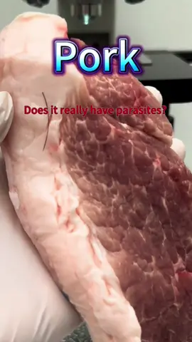 Parasite infection rom eating pork can cause a life threatening infection! #infection #parasite 