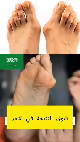 عـــرض لمــدة 3 أيـــام فقط