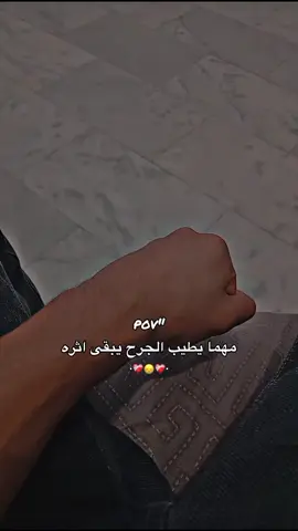 شلون اقنع المقابل اني تعبان وممتحمل حته نفسي😞 #مالي_خلق_احط_هاشتاقات🧢 #fyp 