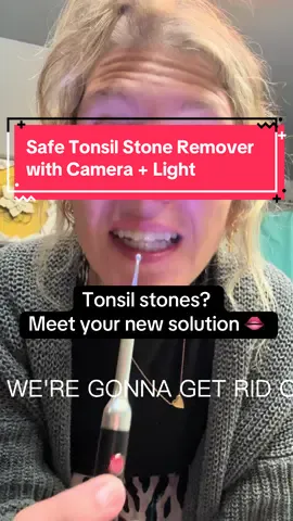 Finally  an easy, way to tackle those stubborn tonsil stones. This tool has a built-in camera + light that connects right to your phone 📲 so you can see exactly what you’re doing. Fresh breath + peace of mind ✅ #tonsilstones 