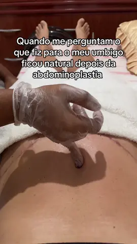 Drenagem linfática com soltura do umbigo  #abdominoplastia #lipo #silicone #fyp #vaiproforyou 