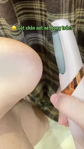 #chamsocchan #maychagotchan #maychagotchancamtay #maychagotchancaocap #gotchan 