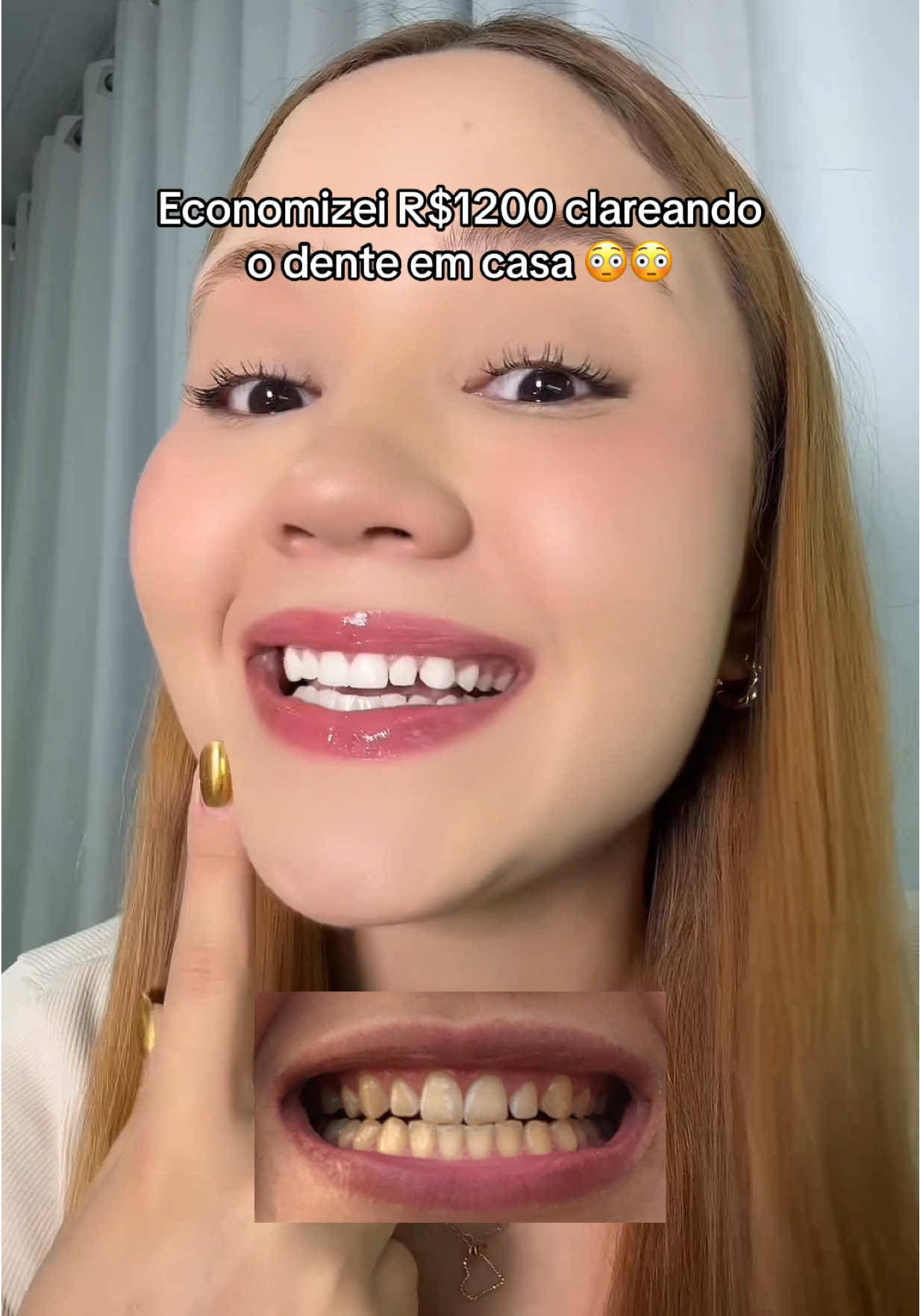 #fyp #dentebranco #fitaclareadora 