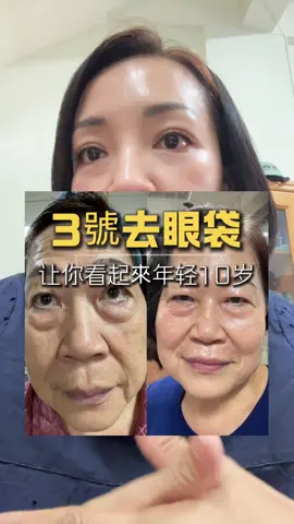 #3號全效緊緻眼霜 ⭐️生活小知識 多休息減少眼部負擔 每晚睡眠是修復肌膚的黃時間，特別是眼部肌膚。 建議每天至少7~8小時的充足睡眠，幫助肌膚在夜間得到良好的修復與再生。 ⭐️眼部按摩小技巧 輕輕按壓眼周，從眉毛到眼尾的部位，這樣不僅能幫助促進吸收，還能舒緩因長時間使用電子產品造成的眼壓。 #童宥榆  #天麗就是我的濾鏡 #天麗生技  #台中天麗美容師  