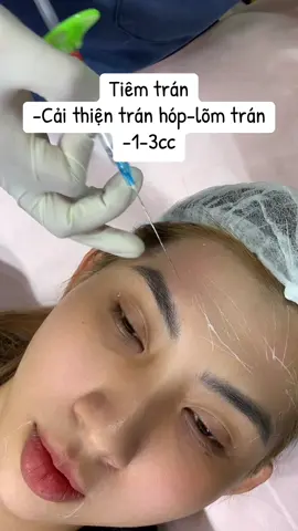 Trán baby-trán tròn#louisdao❤️ #daotaohocvienchuyennghiep #tiêmmoi #fillers💉 