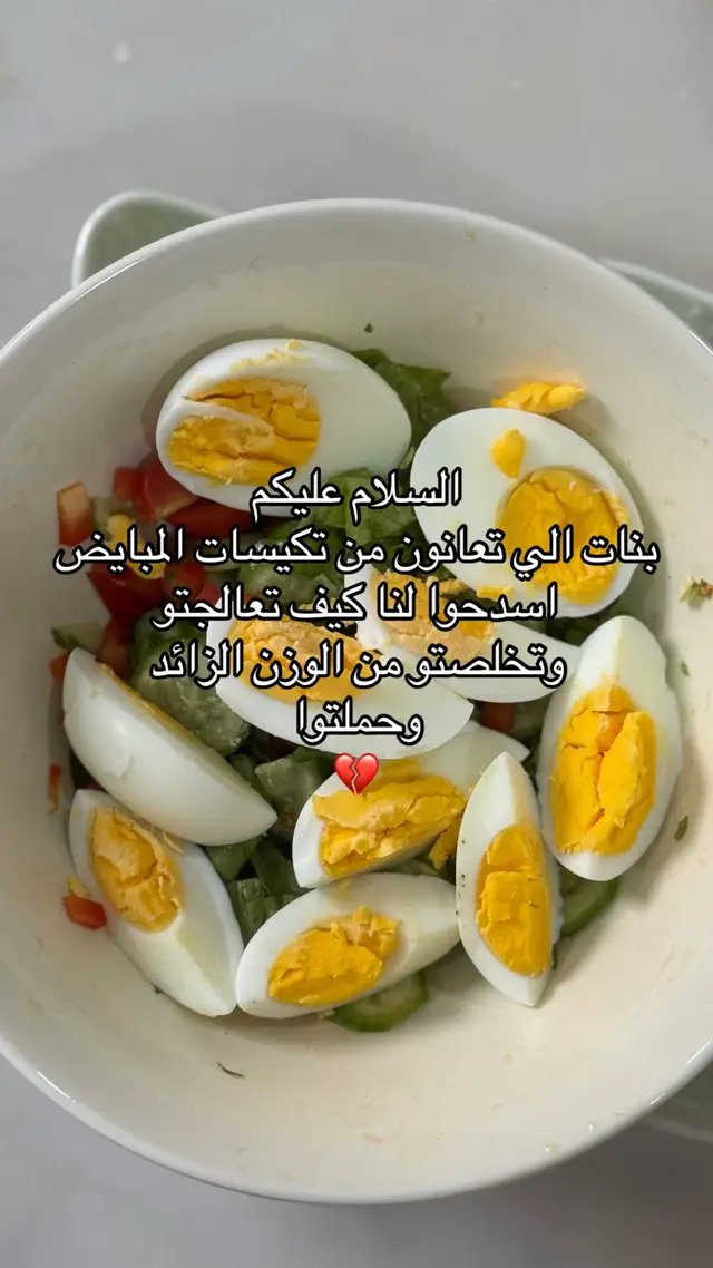 #تكيسات_المبيض #حوامل #حمل #تاخر_حمل #وزن_زائد 