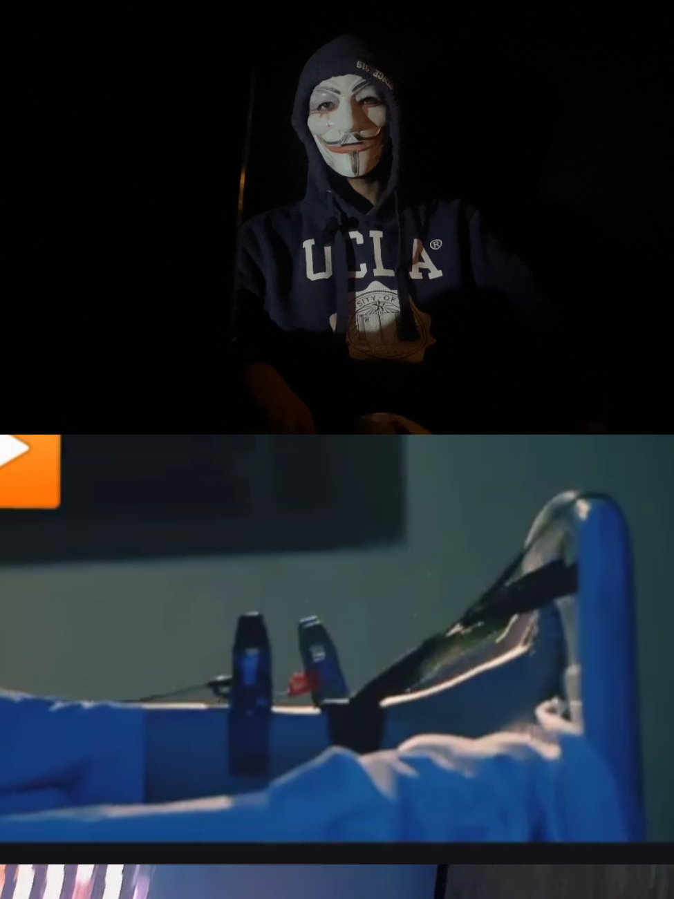 Replying to @wilmarie367 Part 40 Patients with severe mental health Memory erasure treatment conditions that haven't responded latry to other treatments may Frenzana adlikullanıcının receive electroconvulsive therapy Part 2 (ECT), a procedure that involves sending an electrical current to the brain to trigger a seizure seizure Erasing memory the electroconvulsive therapy #darkweb #foryoupage Foryou #sgryan therapy mental #electroconvulsivetherapy greek #greektiktok greekfreakout Greece sofalogia scaryvedios Hidden vedios