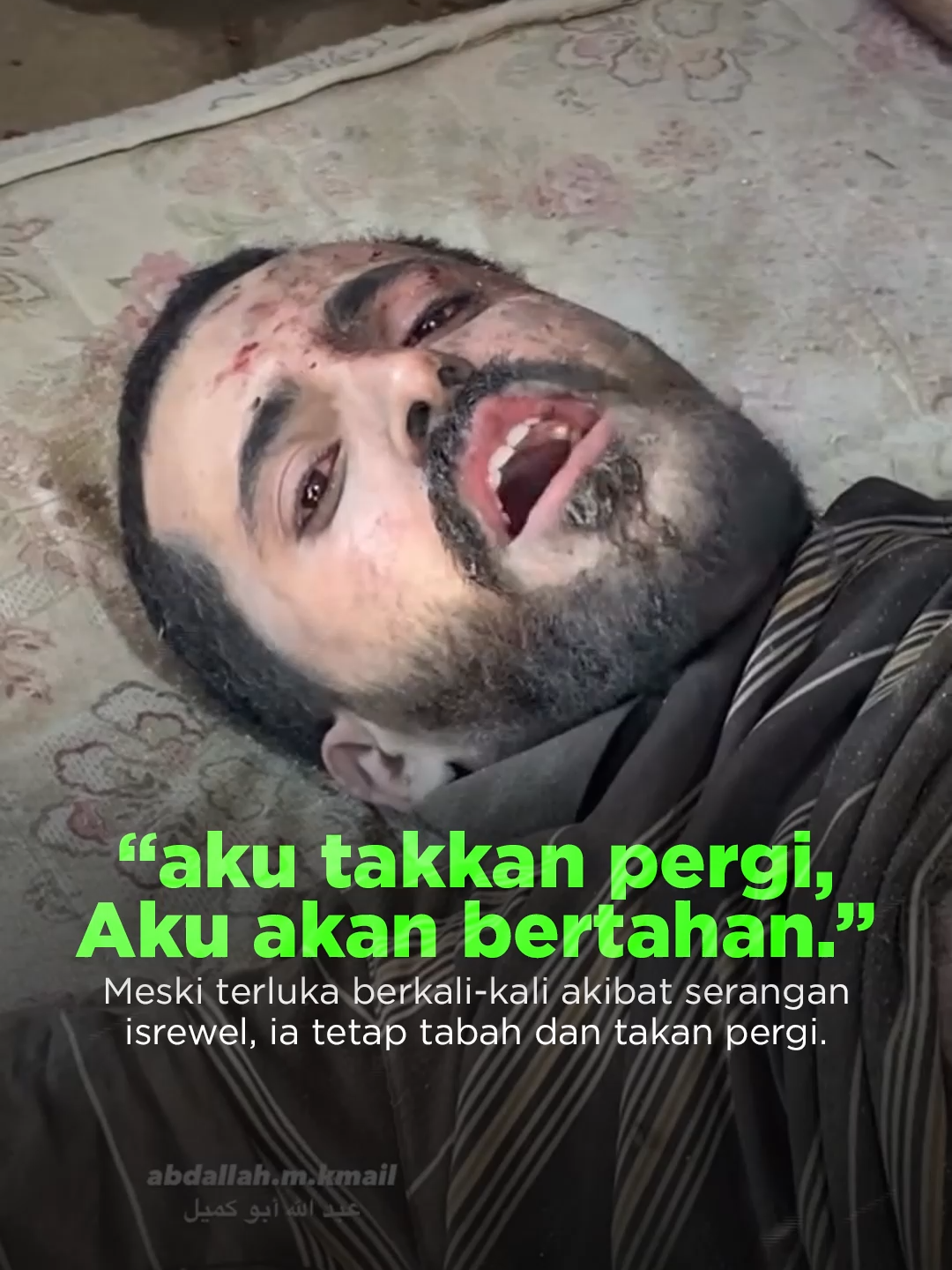 “Aku tidak akan meninggalkan Gaza kecuali ke surga.” 🔥 Dengan suara penuh tekad, Waseem al-Shukri, seorang pemuda Gaza yang kini terluka untuk ketiga kalinya akibat pemboman brutal isrewel, menyampaikan keberanian dan tekadnya. Rumahnya di Kota Gaza menjadi sasaran serangan, lebih dari lima puluh orang berada di dalam bangunan ketika rudal menghantam, meninggalkan puing-puing, jeritan, dan tubuh yang berlumuran dar4h. 📢 Sebelumnya, milit3r isrewel menebarkan ribuan selebaran di Kota Gaza, memerintahkan warga untuk meninggalkan rumah-rumah mereka, memperingatkan tentang mereka akan memperbesar operasi milit3r di wilayah yang sudah terkepung sejak berbulan-bulan. Di tengah kehancuran, rakyat Gaza berdiri dengan keyakinan kokoh dan lebih memilih syahid di tanah airnya. Hasbunallah wani'mal wakiil -- Sahabat dukung terus perjuangan kami dalam membersamai saudara kita di Palestina, dengan berdonasi melalui: ✅ BSI : 7555552698 ✅ Muamalat 1010137934 📌 A.n. Yayasan Amal Produktif Indonesia (termasuk operasional Nazhir) 📞 Konfirmasi Donasi: •⁠ ⁠0822-9597-5445 (Admin Rangga)
