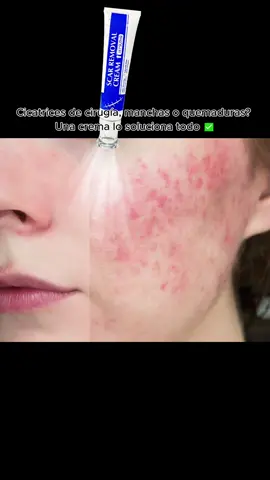 #scar #SelfCare #tiktokshopsummerturnup #fypシ #skincare 