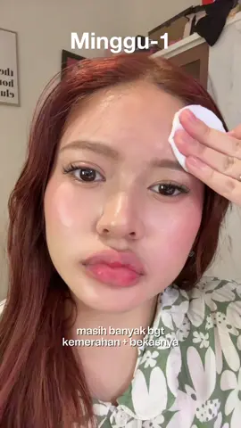 rill ngebantu bgt bgt bgtttt 😵🫠
