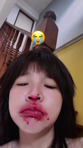 แซ่บนะ#เปิดการมองเห็นเถอะ #อย่าปิดการมองเห็น #เชียงราย 