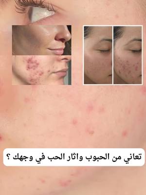 جربي واذا منفعكش نرجعولك دراهمك عرض لوقت محدود