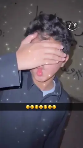 #تهبيد #بريده #شفايف 