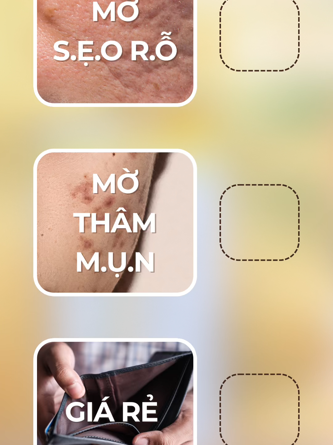 Mờ sẹo rỗ, thâm mụn#sẹo_lồi #sẹo_tai_nạn