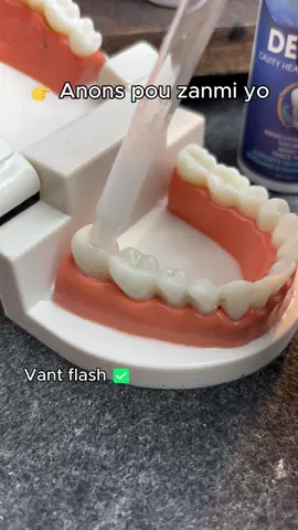 #cavity #yellowteeth #badbreath #hydroxyapatite #teethhealth 