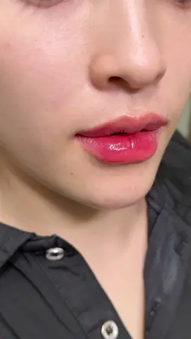 Moii Xinh #filler #haiphong #moixinhhaiphong #xuhuong #xuhuongtiktok