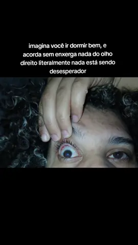 Esse mês está sendo um caos mais sei que Deus está comigo🙌🏻😭 #visao #ceratocone #olhos #problemadevisao #viralllllll 