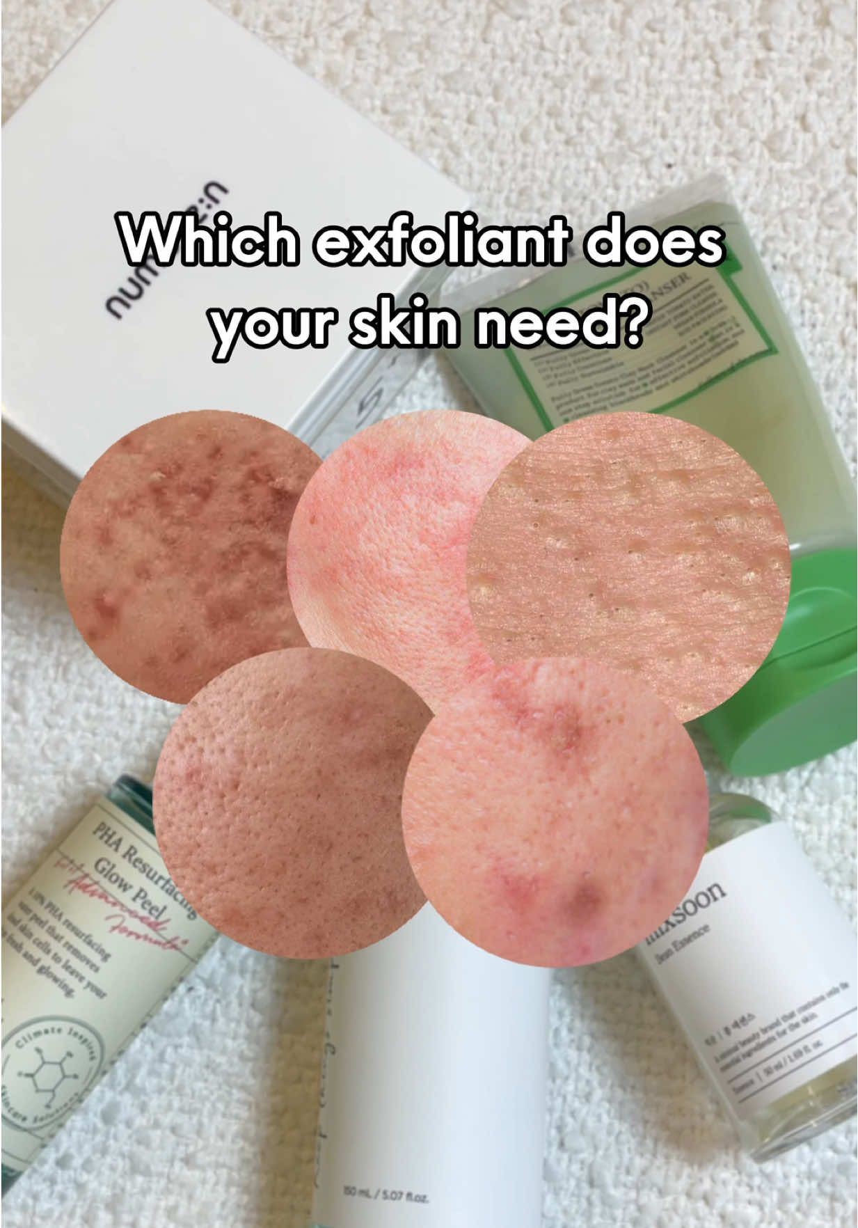 stop guessing and start glowing ✨ here’s your exfoliant cheat sheet: 🤍 sensitive + flaky skin? MIXSOON Bean Essence 🤍 uneven texture got you down? AXIS-Y PHA Resurfacing Glow Peel 🤍 blackheads + pimples being stubborn? ANUA BHA 2% Gentle Exfoliating Toner 🤍 whiteheads taking over? FULLY Green Tomato Clay Pack Cleanser 🤍 acne marks need to go? NUMBUZIN No.5 Vitamin-Niacinamide Concentrated Pad your skin concerns just met their match 💪 which one’s calling your name? #exfoliation #kbeauty #skincaretips #skinconcerns