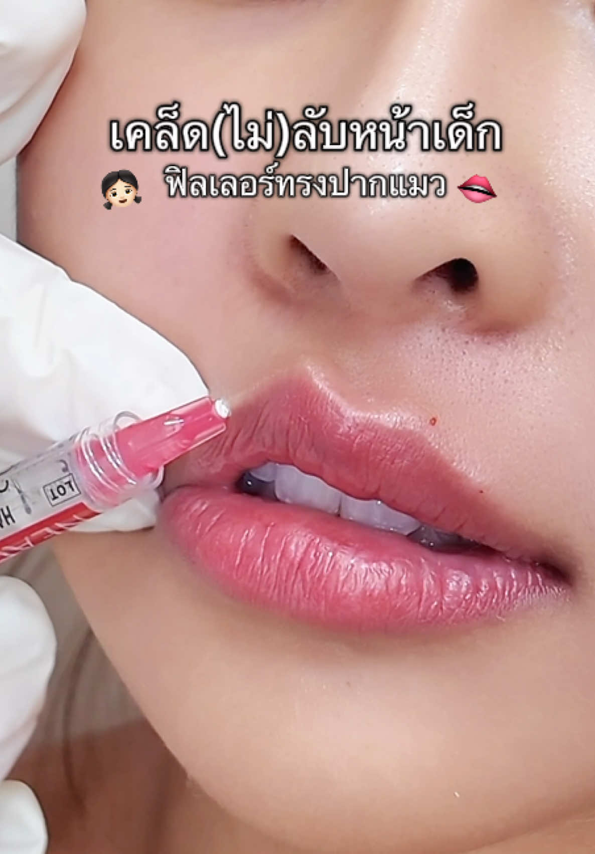 เคล็ดไม่รับหน้าเด็กแบบพี่สาวจีน 😍👄✨  ##ฟิลเลอร์ปาก##ปากแมว##รีวิวบิวตี้##ปากกระจับ