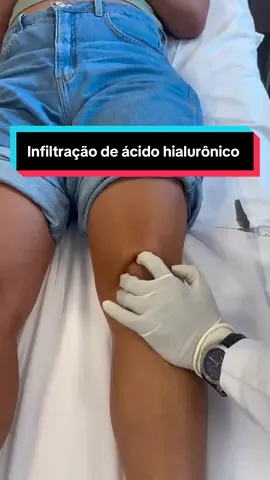 💉✨ Infiltração de ácido hialurônico no joelho: menos dor, mais movimento e qualidade de vida! #Ortopedia #SaúdeDoJoelho #ÁcidoHialurônico #QualidadeDeVida #TikTokMedicina