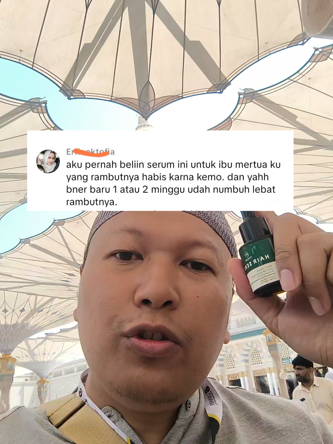 Membalas @arif_budiman888ga perlu sulam rambut kalau cuma pingin rambut subur dan numbuh lagi.  #hairserumampuh #mengatasikebotakan #penumbuhrambutcepat 