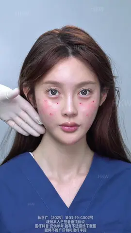 From Puffy to Perfect ✨ Before, my face looked puffy, loose, and saggy — even my apple cheeks were drooping. After the 9D Aesthetic Facelift, the change is huge. Do you love this transformation as much as I do? 💖 #9DFacelift #FacialRejuvenation #YouthfulGlow #NaturalAesthetics #timelessbeautyasthesea 