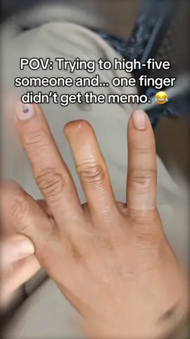 POV: Rearranging my fingers like a puzzle… some pieces are missing! 🧩😆#foryou #fyp 