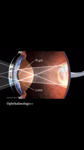 Ophthalmology >>#medicine #fyp #opthalmology #biology #fyppppppppppppppppppppppp 