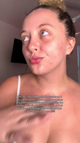 only pimple patches i will use especially with acne prone skin 🫶🏼 @PatchRX #pimplepatch #patchrx  #acneproducts #patchrxpimplepatch #skincaretips  @taaylorrb ⭐️  @taaylorrb ⭐️ 