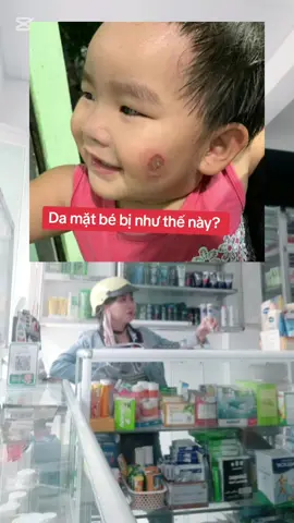 Da mặt bé bị ntn ?#sachquycheduoc #xuhuong #huongdansudungthuoc #duocsilieu 