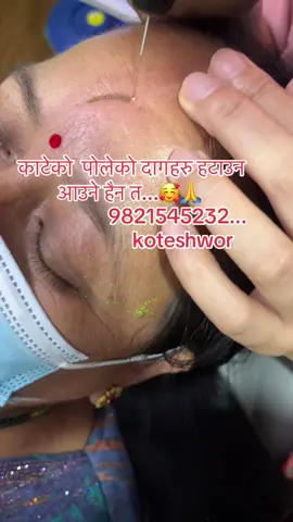 #scar #removal #pigmentation #daag #wrinkles 