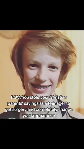 #blackpil #ehren #surgery  Ehren's parents always cared about his looks so much so at 14/15/16 (idk exactly what was his age this guy looks are confusing tbh) he got braces ehren financial state isn't the best and i will tell you why.at 17 ehren stole all of his parents savings and went to a plastic surgeon illegally and got the implants that giant implants made for him you might ask how didn't his parents notice? they did but before he got the surgery he kneeled in front of a cross and prayed to be good looking so when they saw him the next day they thought it was jesus work or some shit like that.