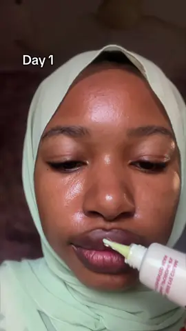 7-days lip glow up challenge ✨ I used the Seoul 1988 eye cream on my lips for 7 days and the results 💕 .Faded pigmentation,brighter lips and smooth texture .Retinal is not only a glow up for your face but your lips too @KSECRET GLOBAL  #KSECRETGlowChallenge #KSECRET #Seoul1998 #PigmentationCare 